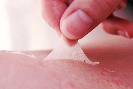 Слабая степень ожрога