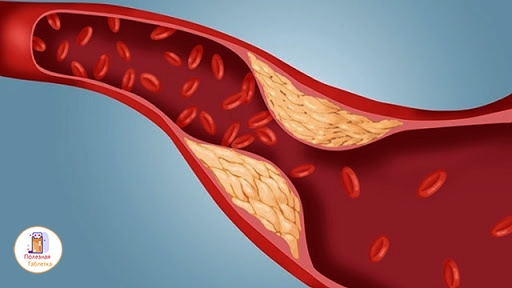 Как снизить холестерин