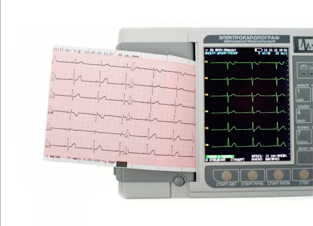 Фото автора. Аппарат для записи экг детям всех возрастов