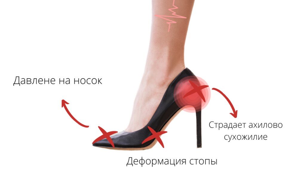 Источник: Яндекс. Картинки