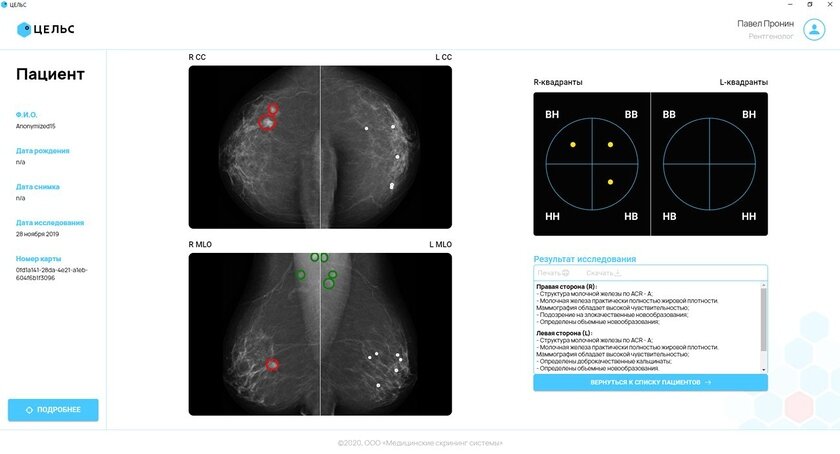 ООО «Медицинские скрининг системы»