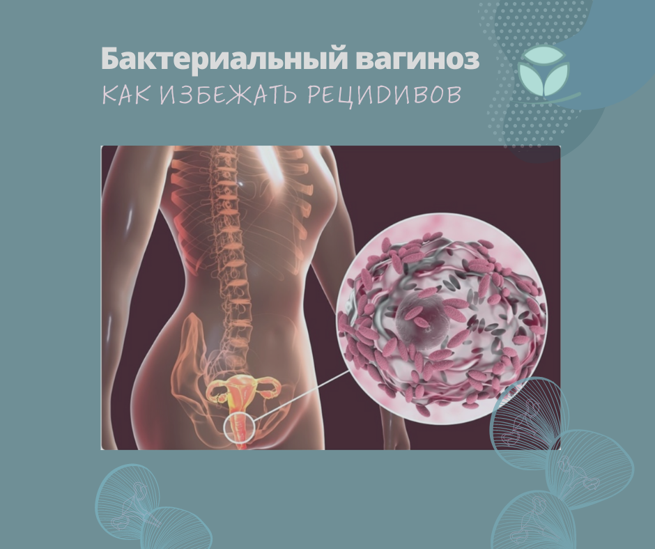 Бактериальный вагиноз, гарднереллез, дисбиоз, дисбактериоз влагалища: причины, симптомы, лечение