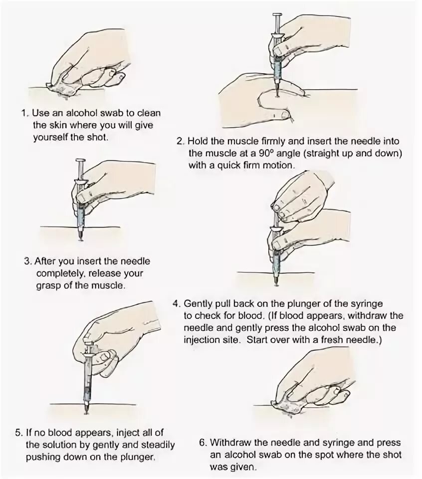 Как правильно делать укол в ягодицу в домашних условиях взрослому для начинающих с фото