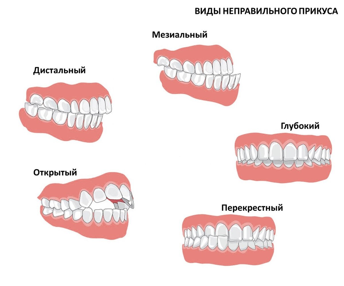 Картинка использована из открытого доступа