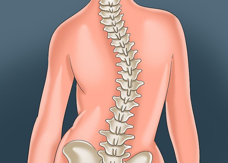 Сколиоз - что это, степени, причины, лечение