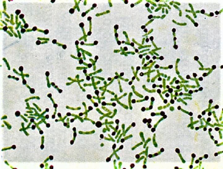 Corynebacterium diphtheriae фото