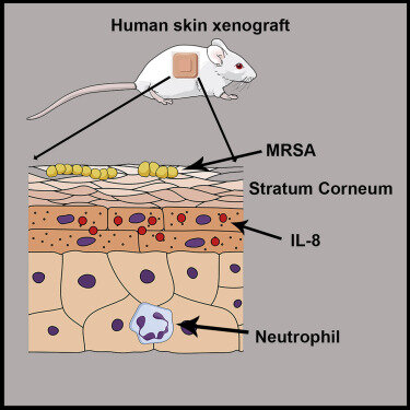 Изображение схемы взаимодействия в коже бактерий MRSA и нейтрофилов, которые были вызваны к месту заражения цитокинами IL-8