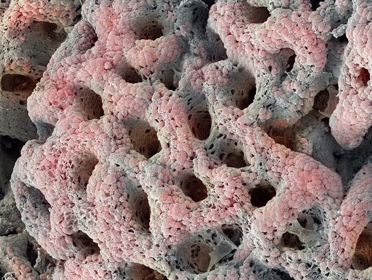 STEVE GSCHMEISSNER / SPL / Getty Images