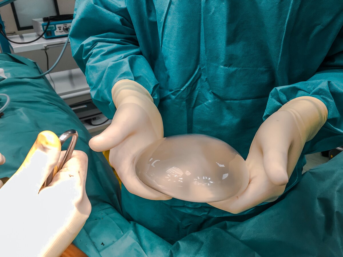 Фото из личного архива пластического хирурга Лигатюка Д.Д.