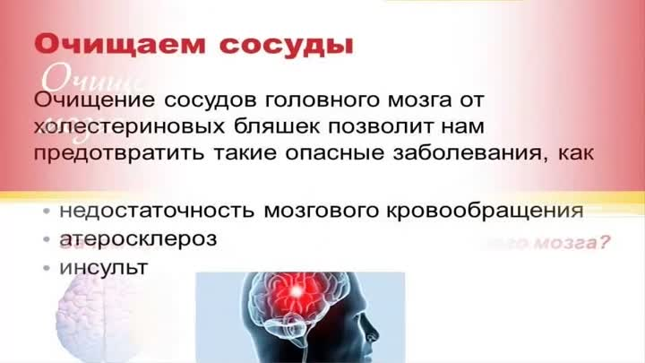 Народный метод очистки сосудов. Продукты для очищения сосудов головного мозга. Чистка сосудов головного мозга. Средство для очищения сосудов головного мозга. Продукты для очищения сосудов головного мозга.