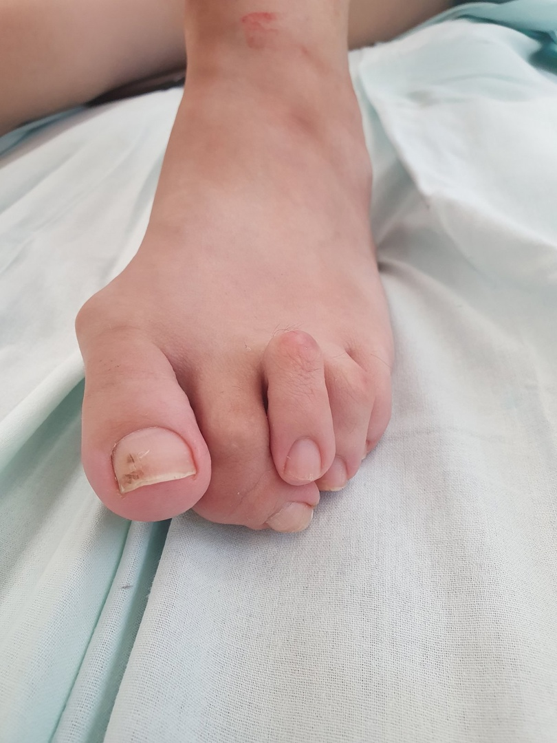 До операции 