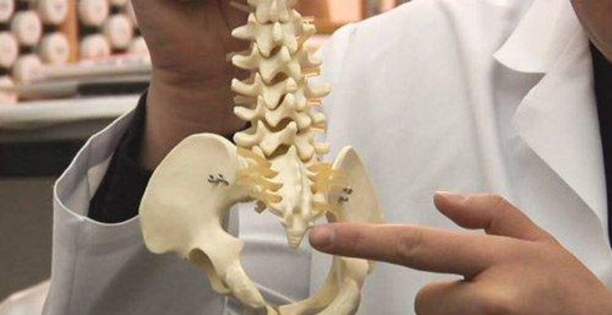 Как ушибить копчик. Осколочный перелом копчика. Переломы копчика классификация. Ушиб копчика при падении. Травмированный копчик.