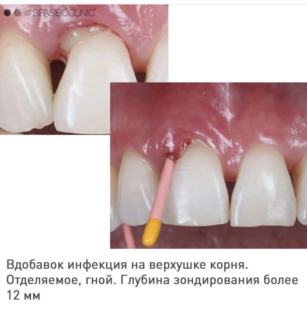 ВЫТАЩИТЬ И ВЫЛЕЧИТЬ | Спасибо.Клиник | Дзен