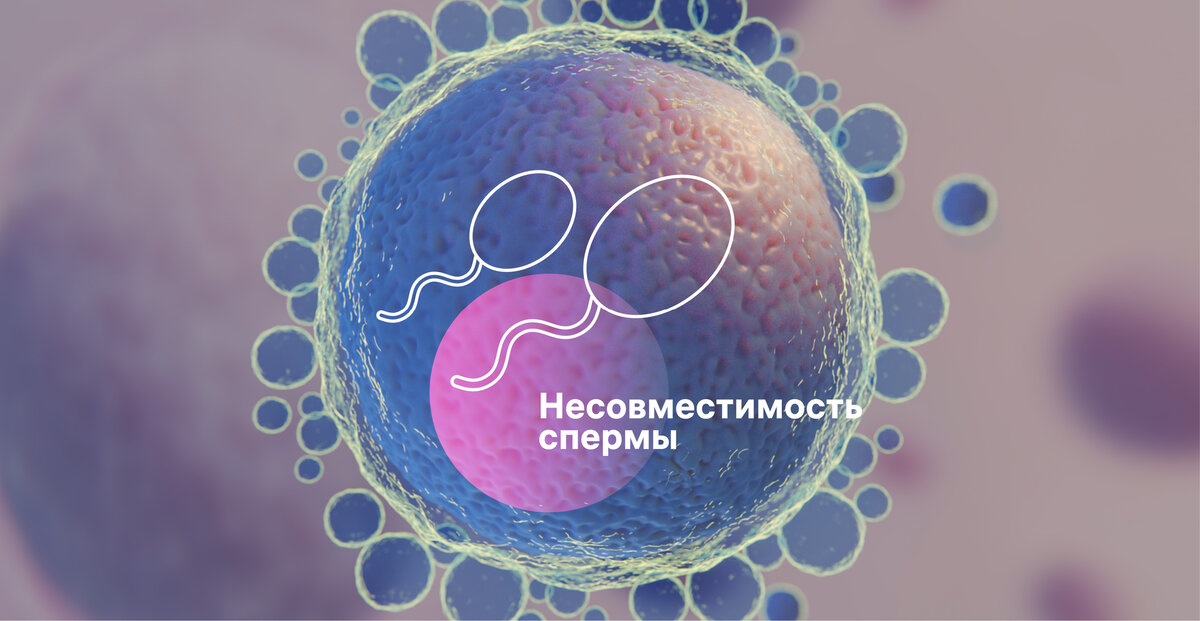 Иммунологическое бесплодие и роль антиспермальных антител в нем