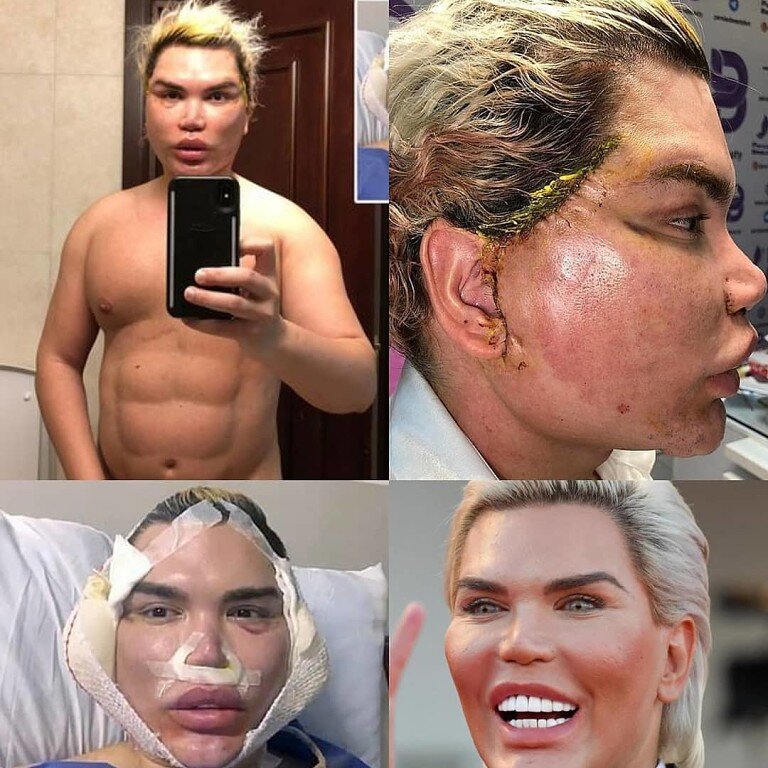 35-летний Кен уменьшил лицо.