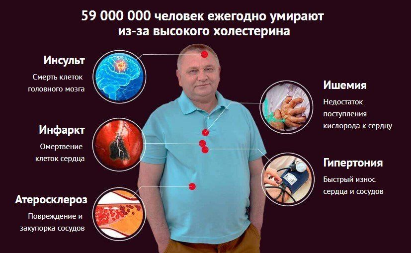 Последствия высокой. Симптомы высокого холестерина. Признаки вычокого холестерин. Последствия высокого холестерина. Симптомы высокого холестерина в крови