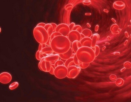 Слипшиеся эритроциты, которые могут привести к закупорке сосудов