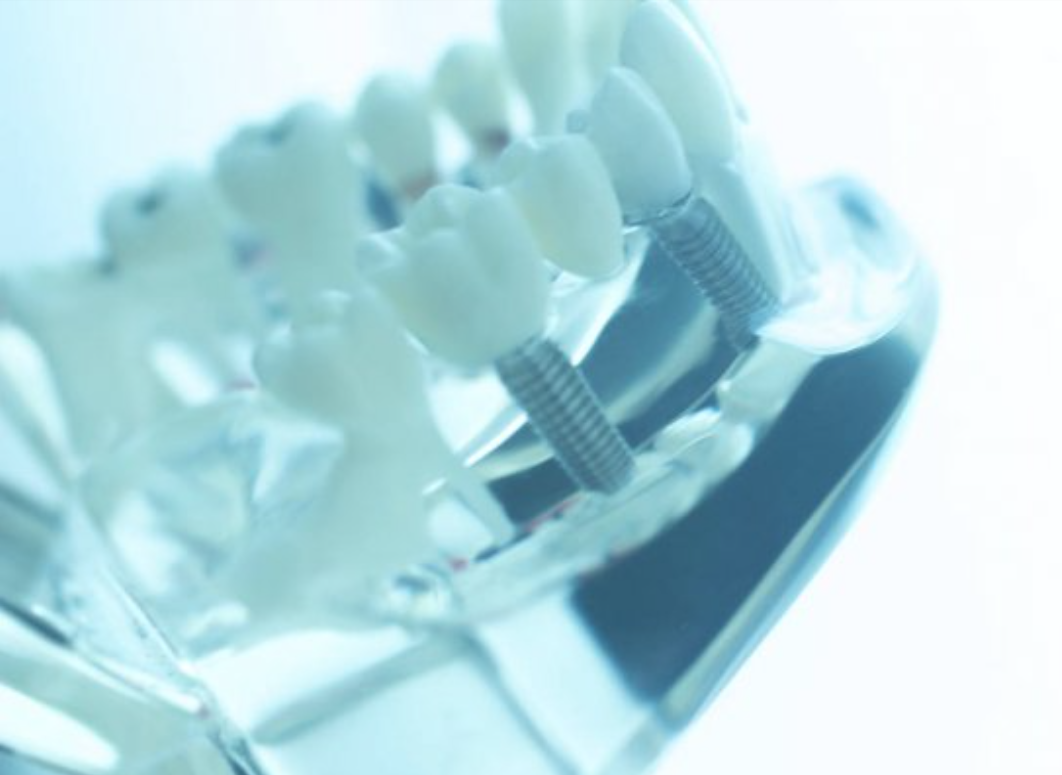 Часто при установке имплантатов в области седьмых зубов врач требует ...