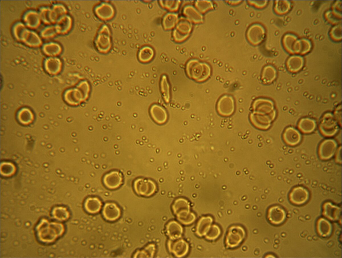 Личинка аскариды в поисках питания