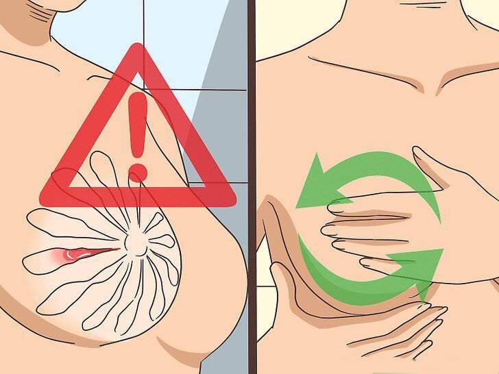 Как избавиться от застоя молока при ГВ и после его завершения 