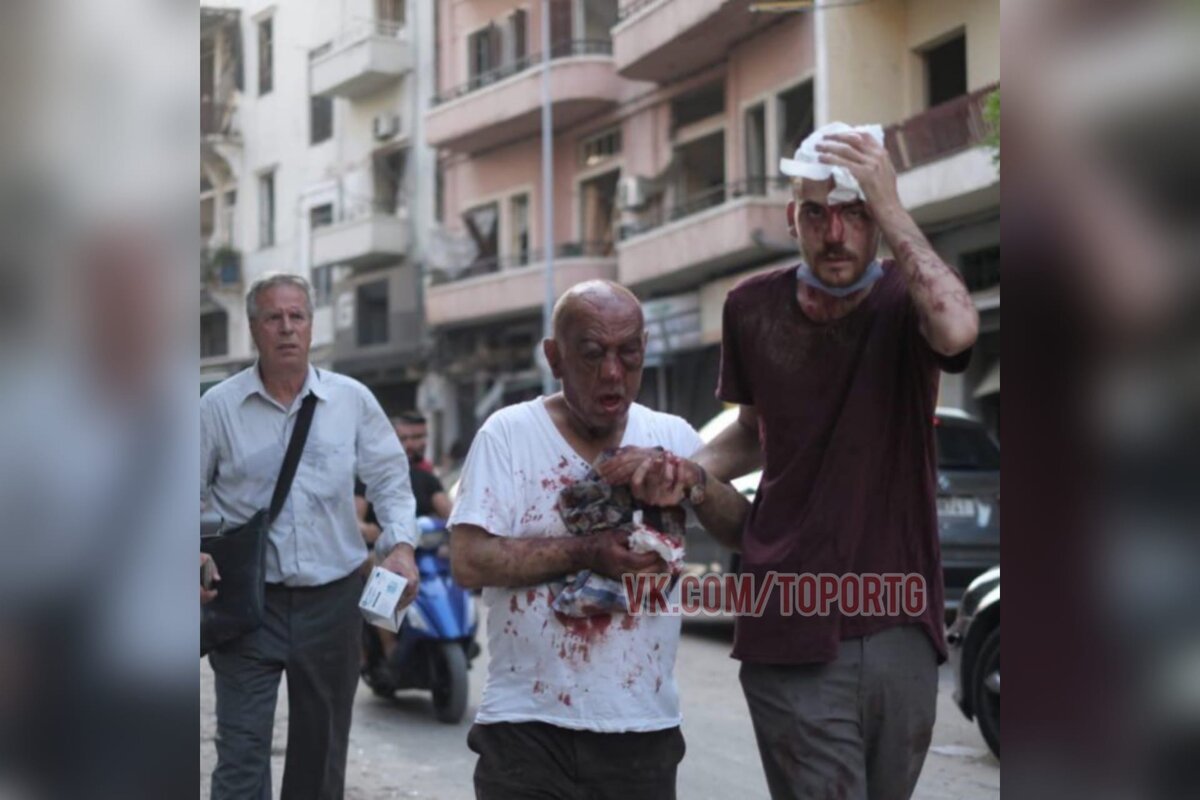 Пострадавшие 