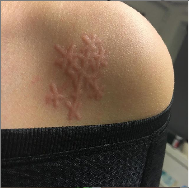 Источник изображения: instagram.com/dermatographia