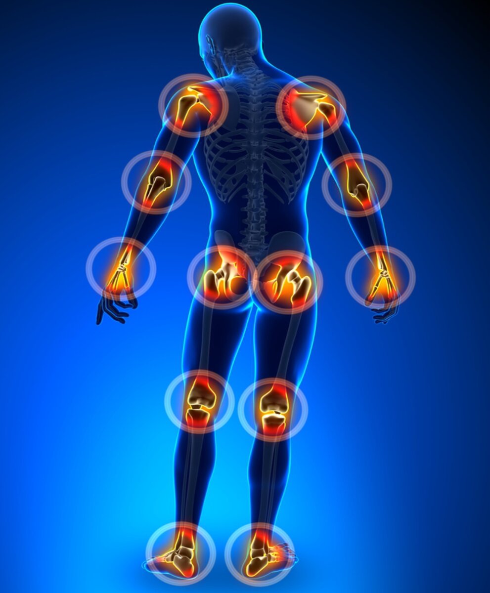 Все суставы человека на картинке