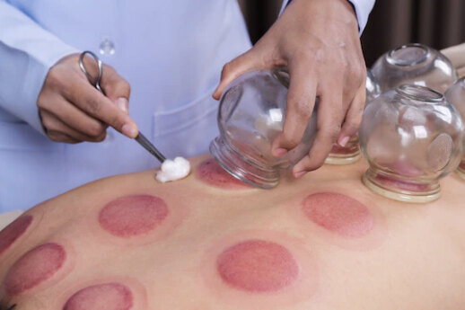     Советский метод лечения банками: взгляд со стороны современной медицины