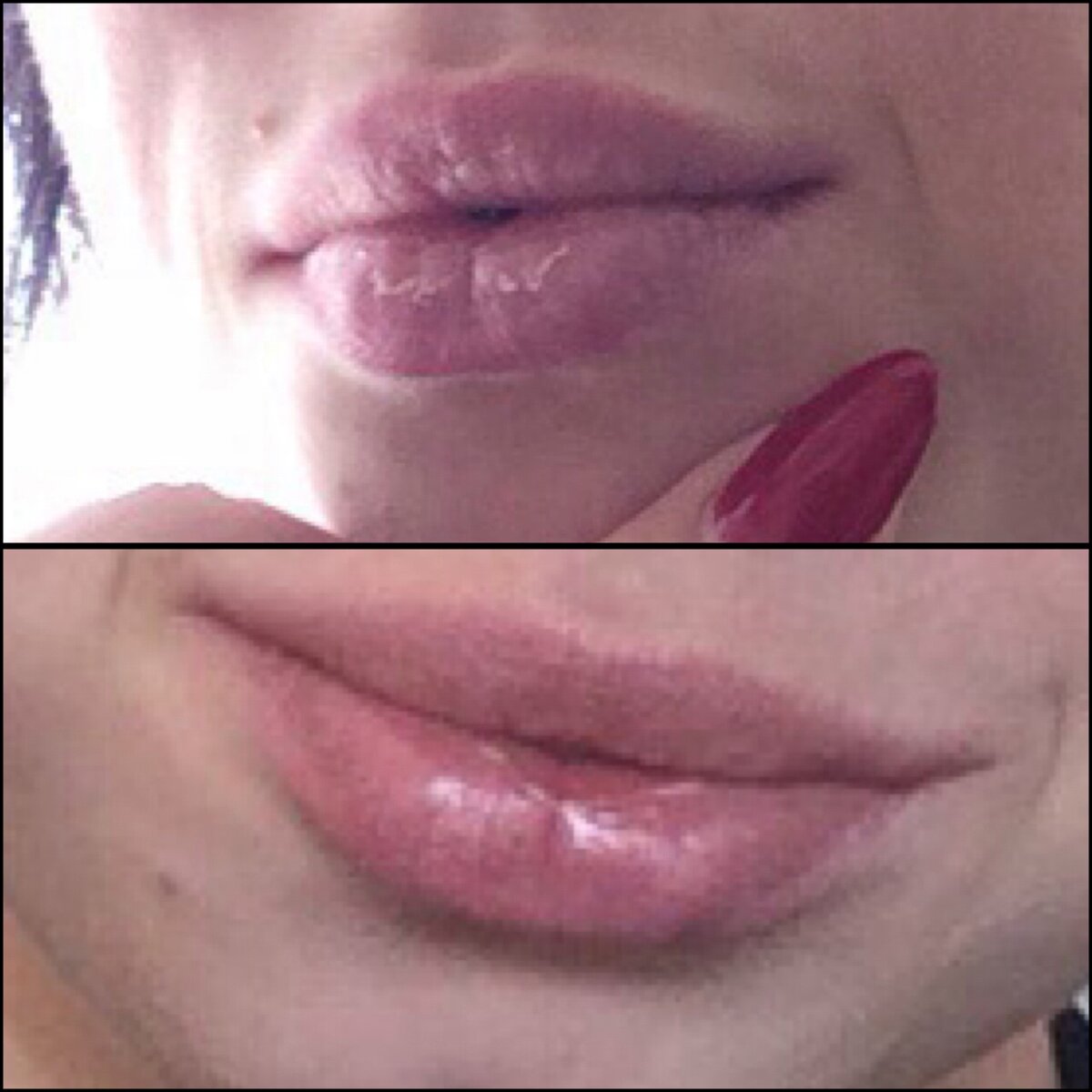 До и после применения Боро Плюс