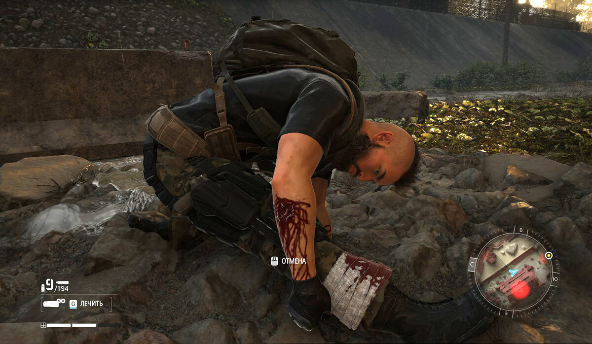 Хорошенько бинтуемся.