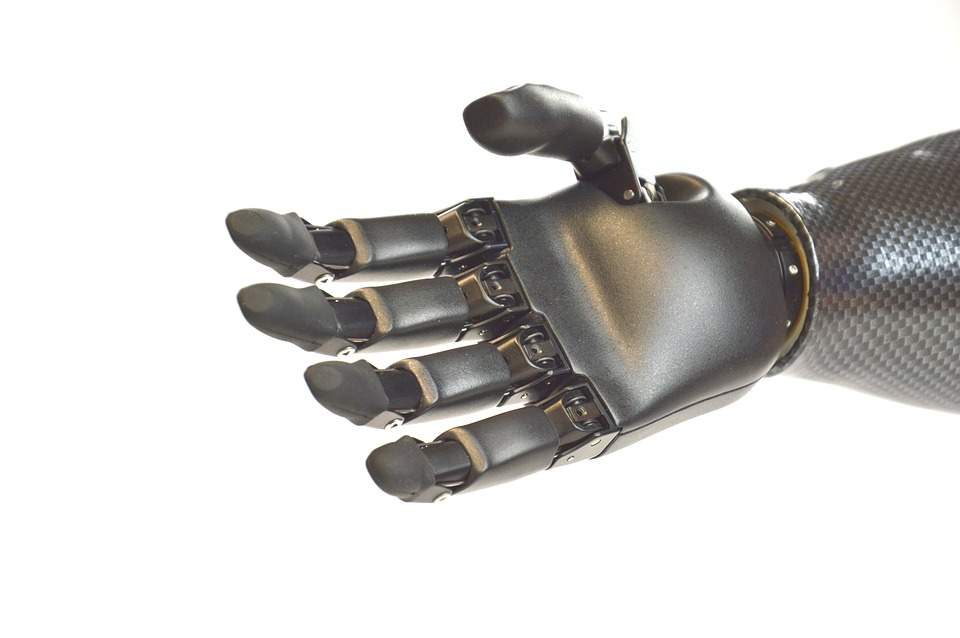 https://cdn.pixabay.com/photo/2018/12/03/12/03/hand-prosthesis-3853281_960_720.jpg