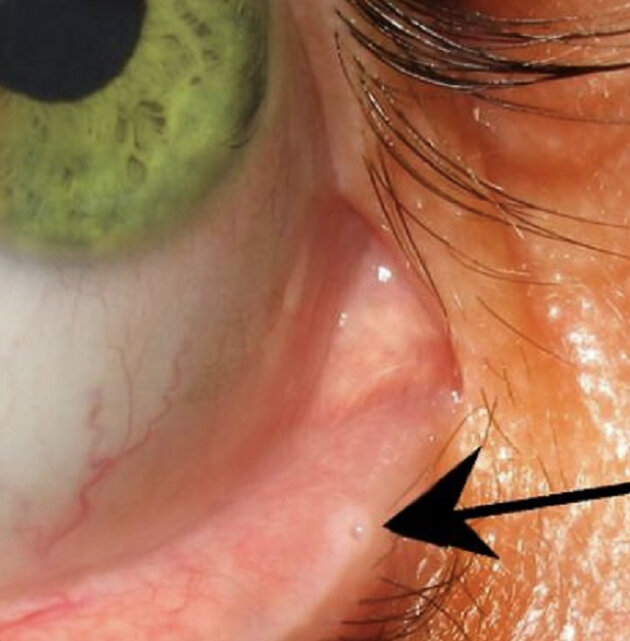 Это отверстие можно увидеть немного опустив пальцем нижнее веко глаза.