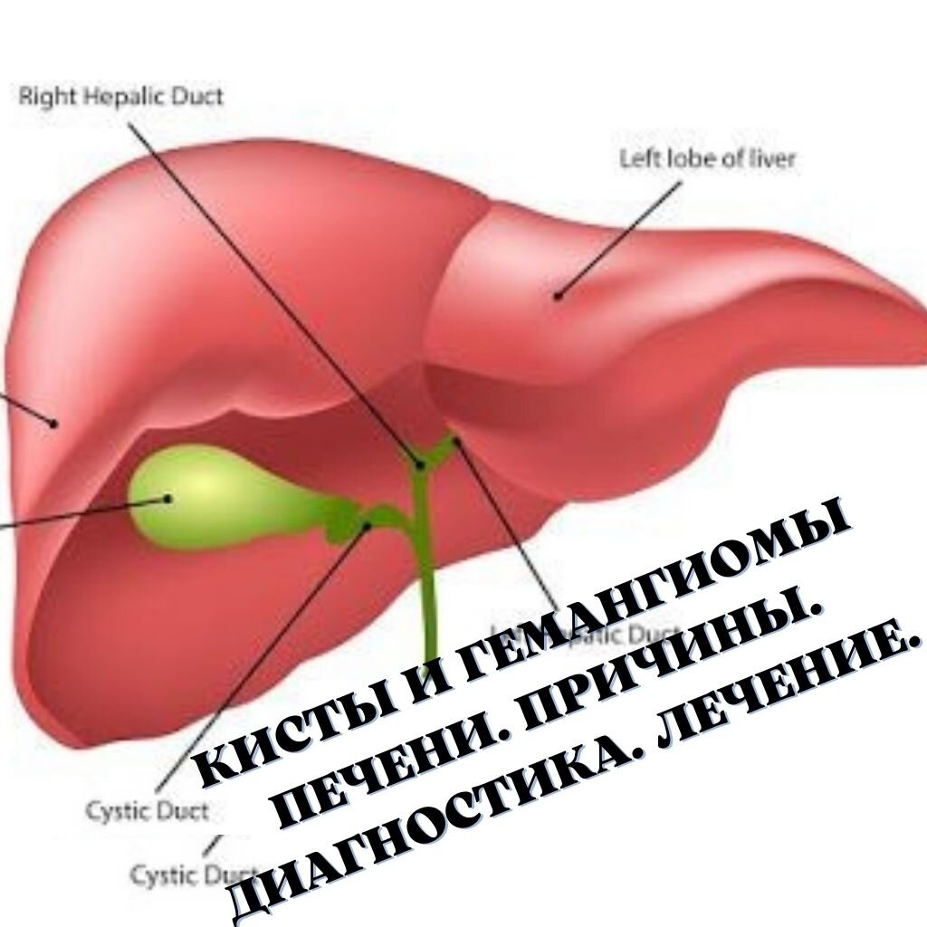 Как выглядит киста на печени