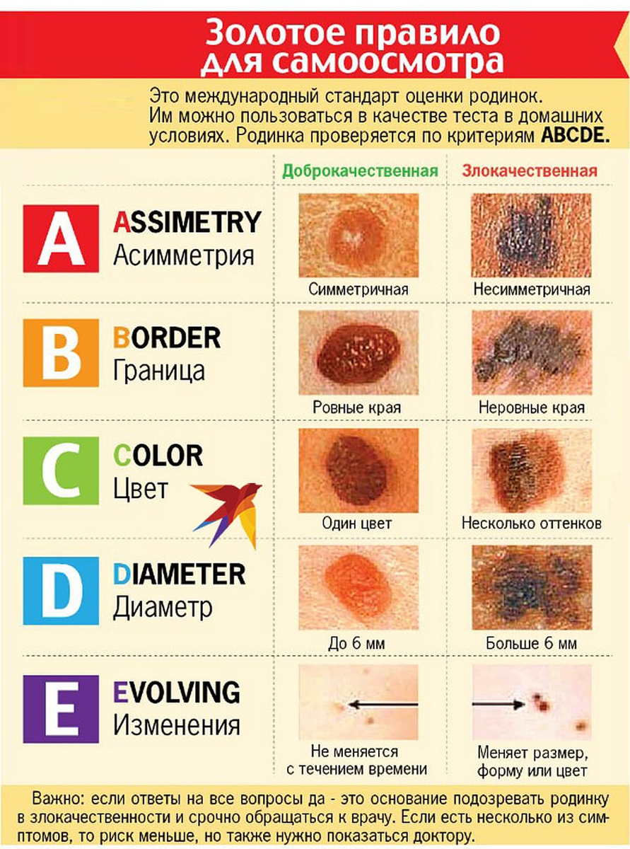 Проверить родинку на онкологию в красноярске по фото