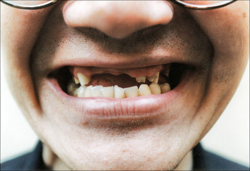 ЯндексКартинки