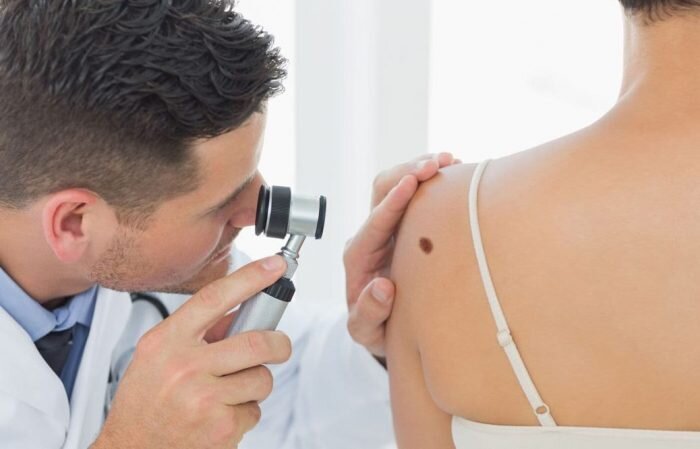 Перед удалением папилломы обратитесь к врачу за консультацией