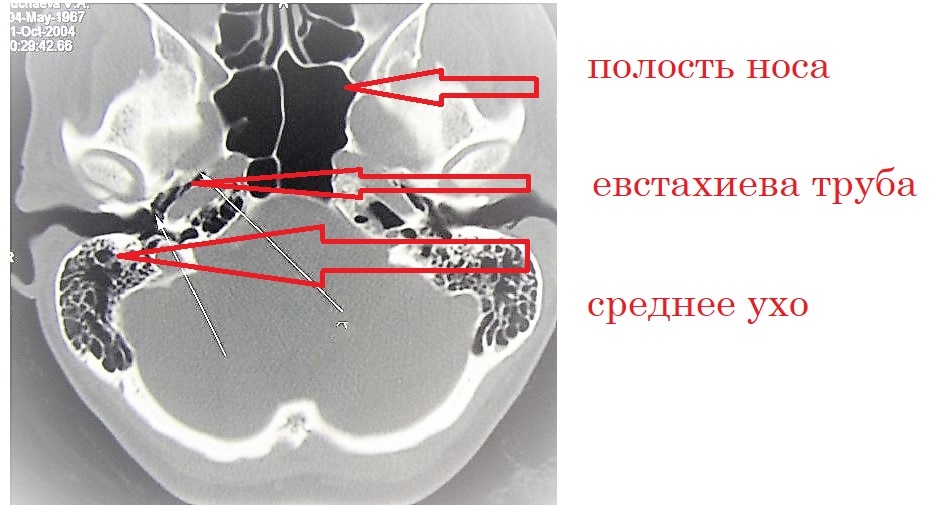 Как промывать нос правильно