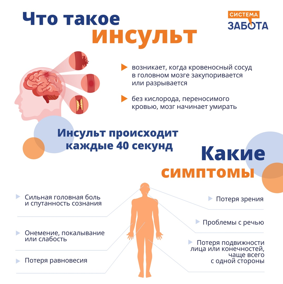 Инсульт что это такое и причины