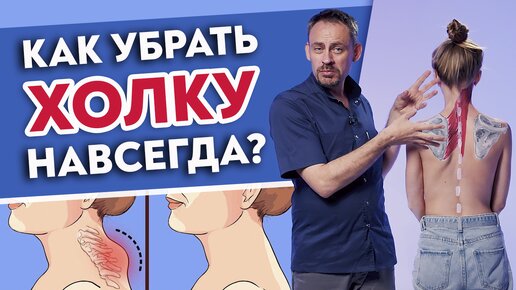 Download Video: Любая холка уйдёт НАВСЕГДА! Два шикарных упражнения уберут ВДОВИЙ ГОРБ!