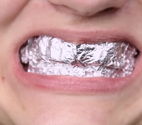 Полоски на зубах