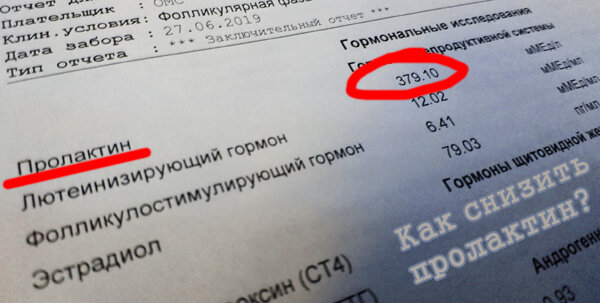 Повышенный пролактин у женщин: причины и симптомы