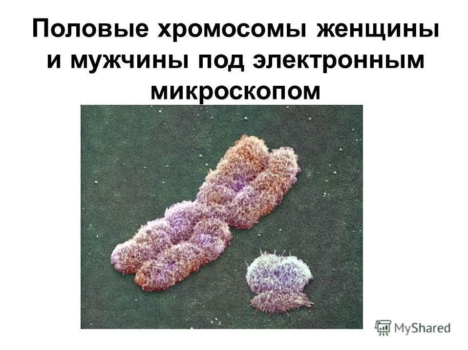 X и y хромосомы. Половые хромосомы. Половые хромосомы женщины и мужчины. Женские хромосомы. Женские половые хромосомы.