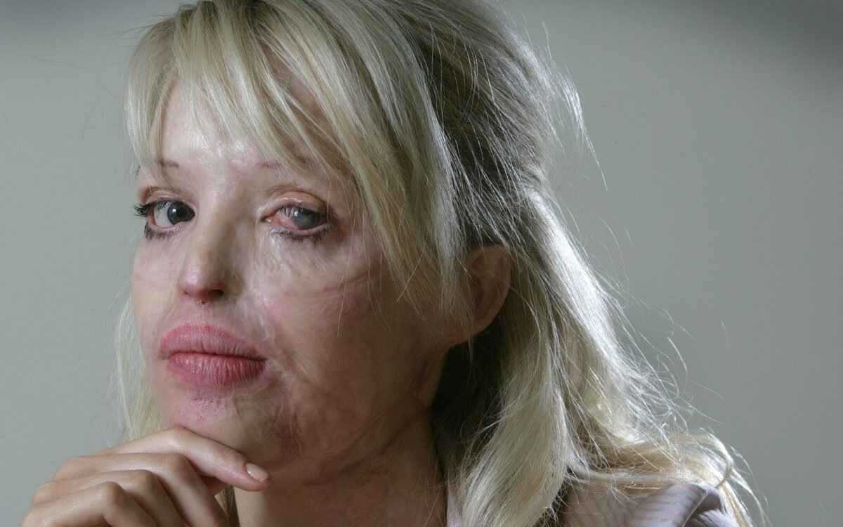 Фото использовано в качестве иллюстрации. Открытый источник Яндекс - картинки.