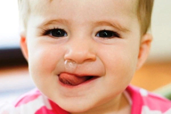 Прозрачные сопли у ребенка к зубам?. Сопли из за зубов у ребенка.