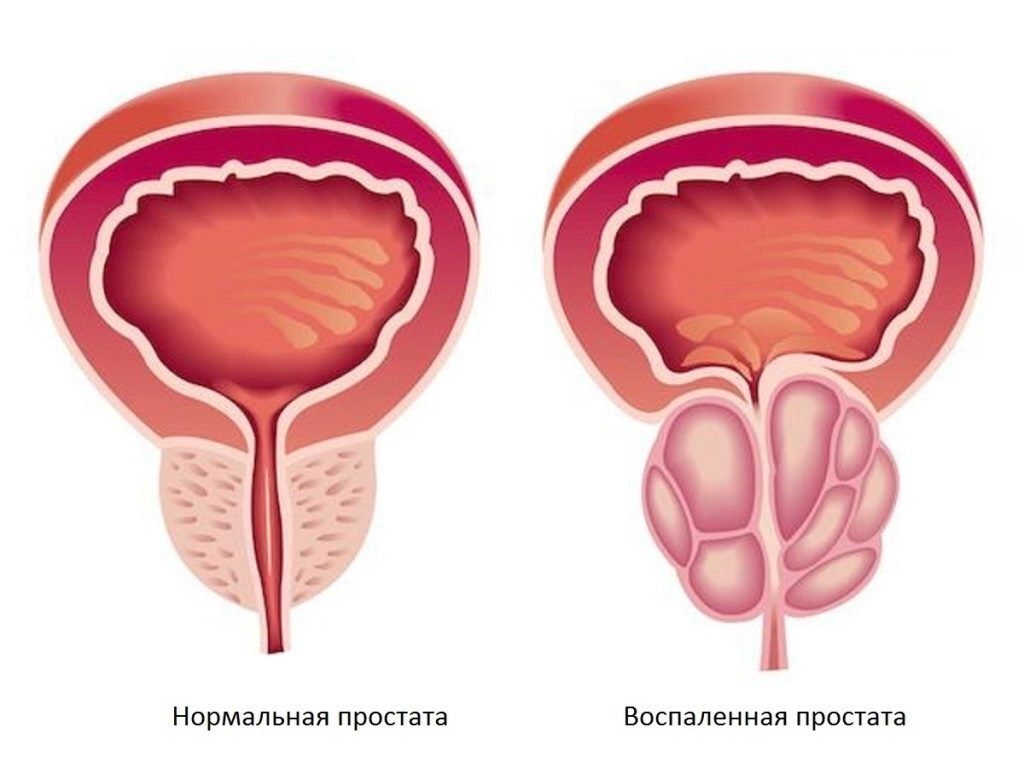 Мужская половая система | Статьи МЦ «Диагностика