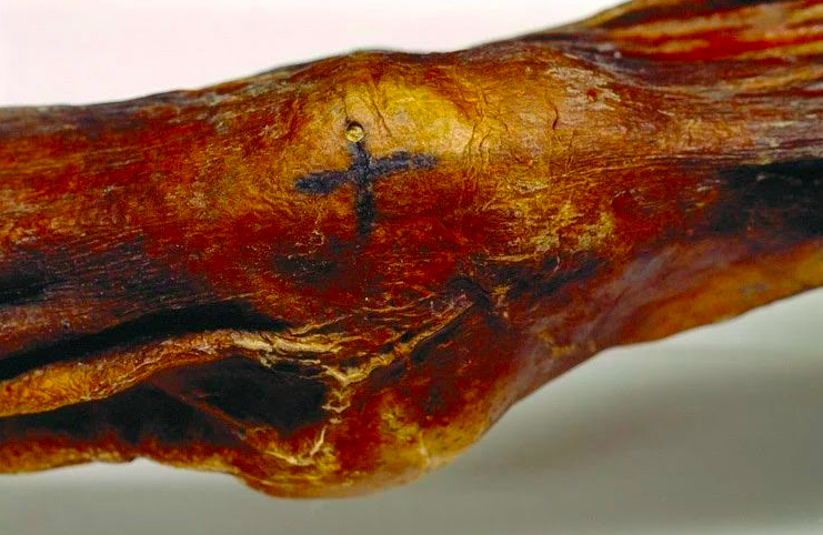 Её же коленка