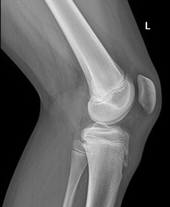 Вот так это выглядит на снимке