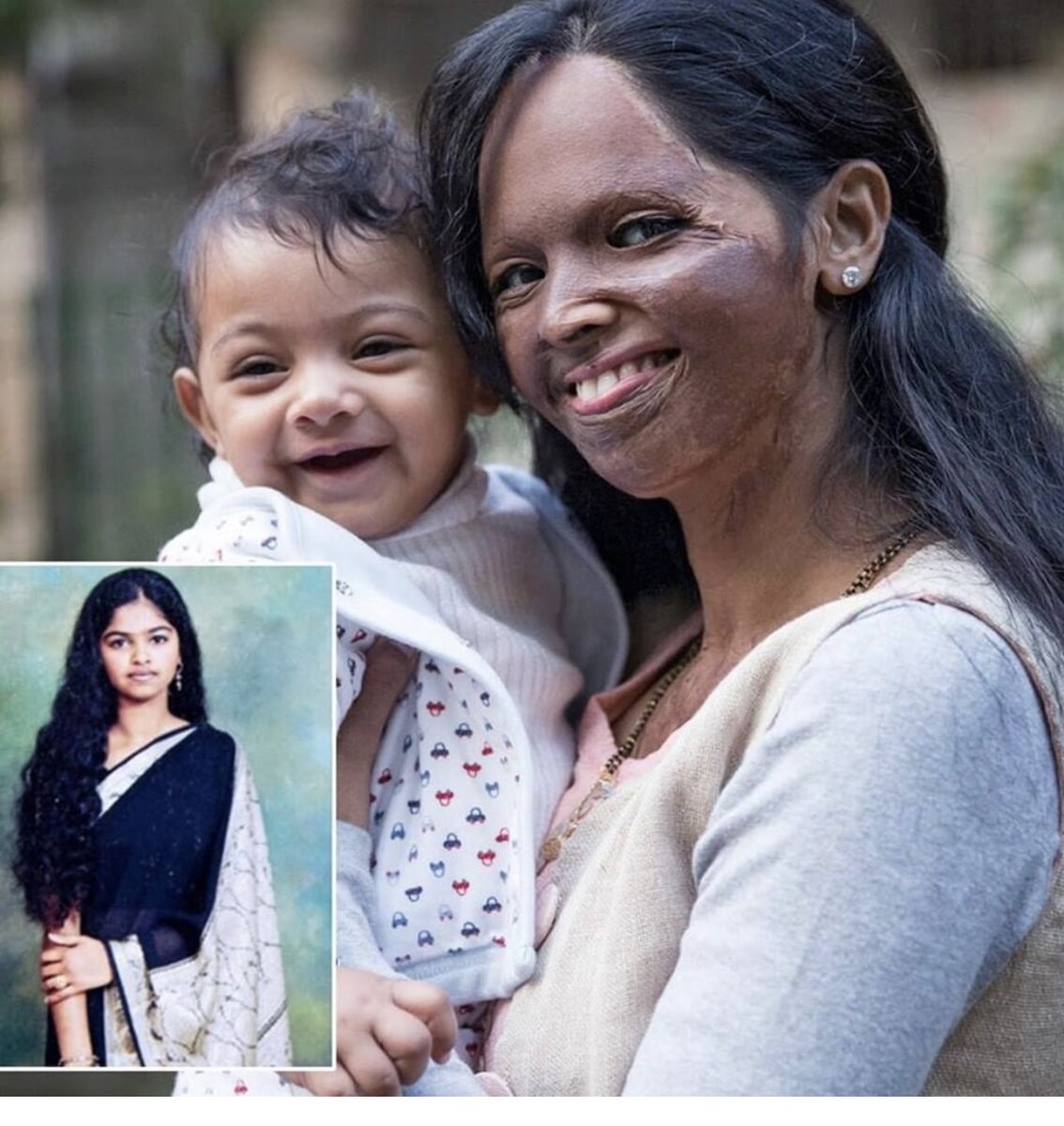 Лакшми Агарвал с дочкой. На маленькой фото Лакшми до нападения.