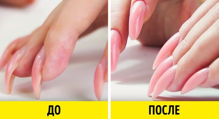 Клюющие ногти