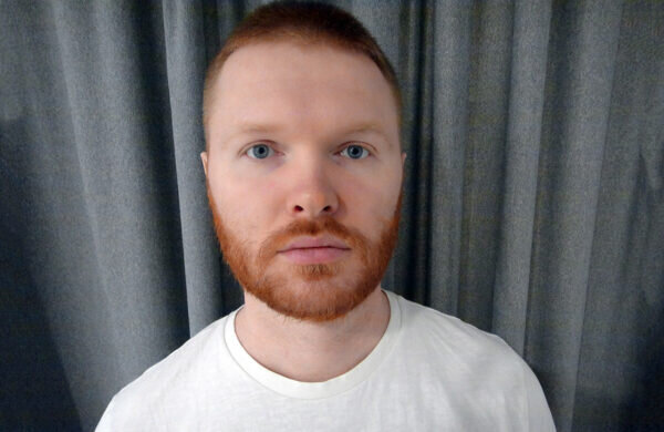    «Это просто давление, выпейте таблеточку и домой». Врачи не стали госпитализировать Антона Мария Строганова